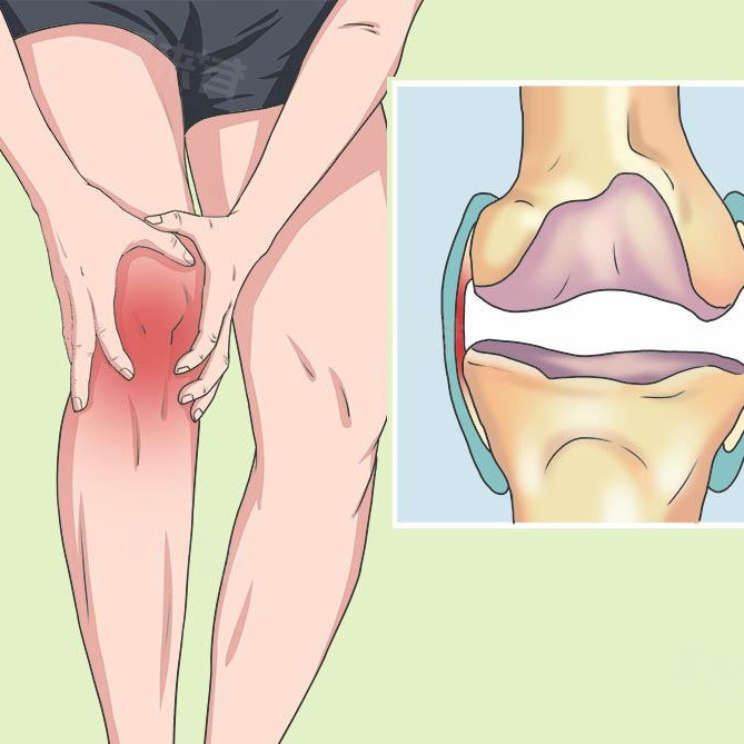 Đau viêm khớp gối do thoái hóa - Hạc tất phong